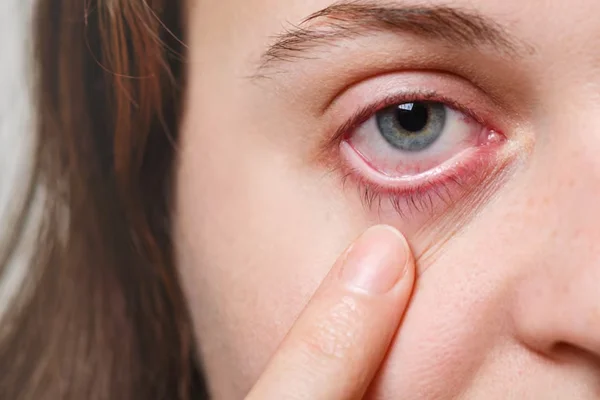 Pterygium Surgery
